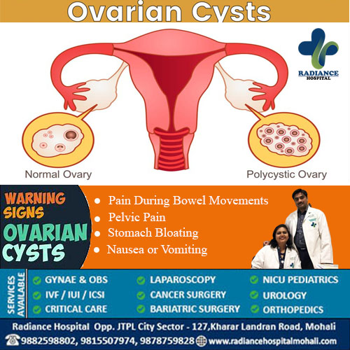 ovarian cyst pain symptoms